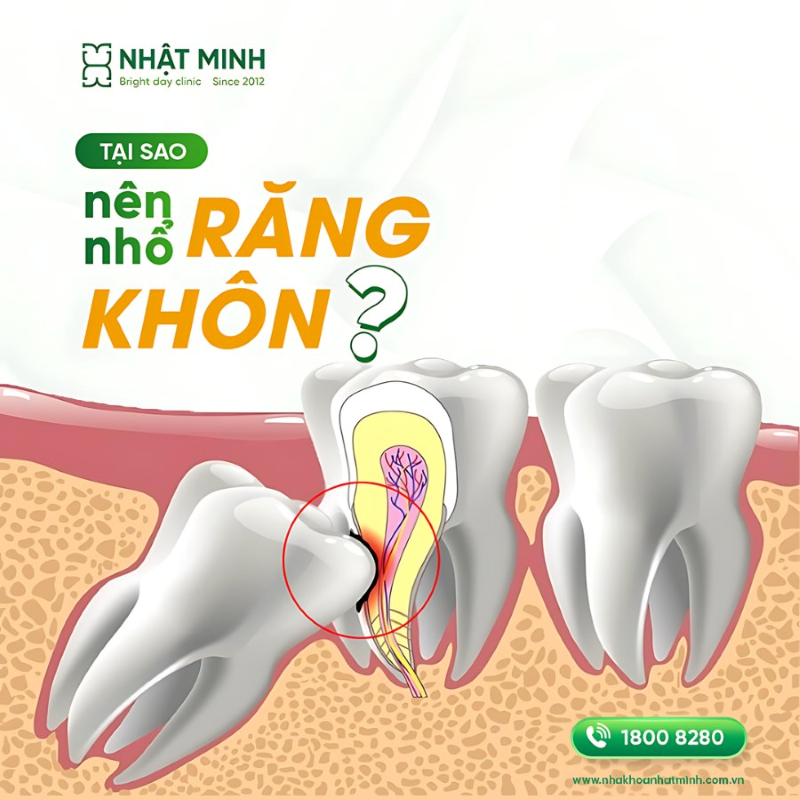 Răng khôn gần như không có tác dụng về mặt thẩm mỹ hay chức năng nhai, chiếc răng này thường mang lại phiền toái vì trong quá trình mọc răng khôn ngoài gây sự khó chịu mà còn có thể gây ra nhiều biến chứng ảnh hưởng đến sức khoẻ